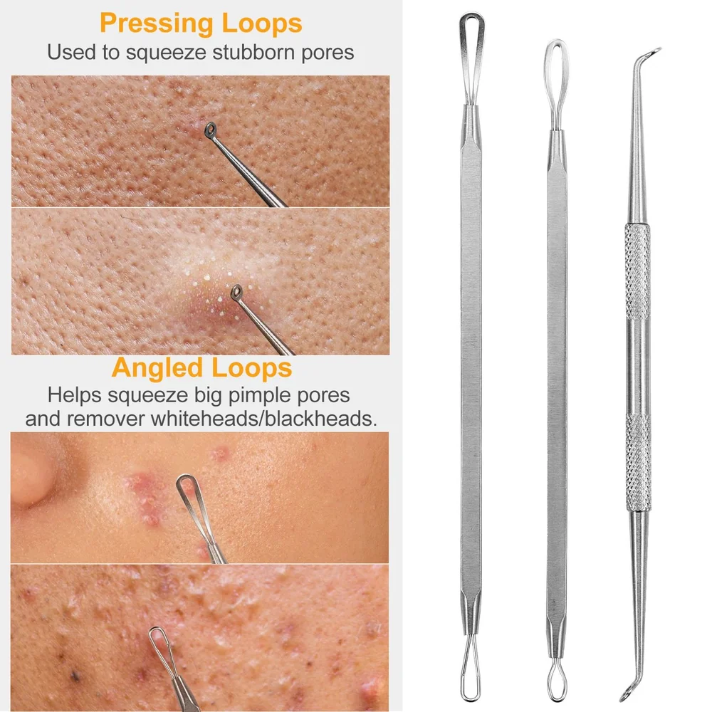 Stainless steel pimple extractor tools demonstrating pressing and angled loops for effectively removing blackheads and whiteheads from skin pores.