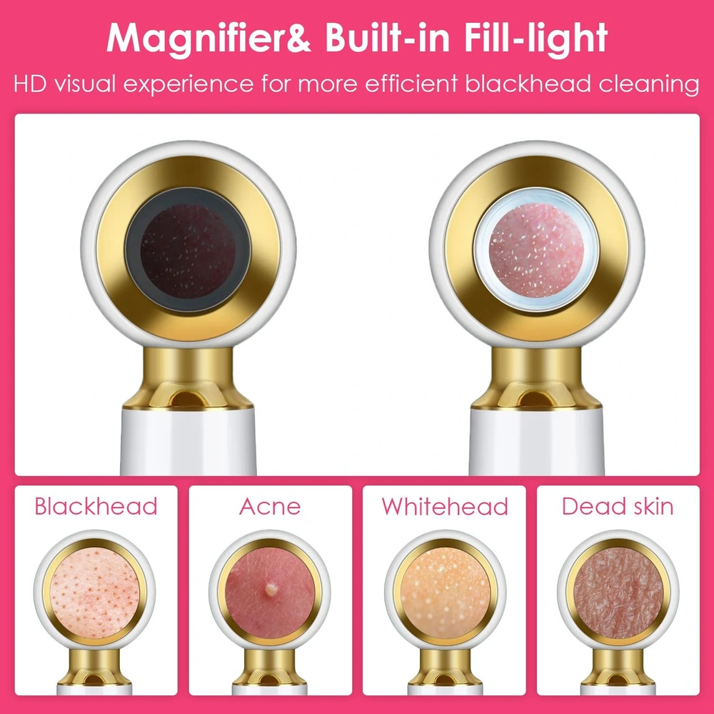 Close-up of a magnifying facial tool with built-in light, showcasing its ability to enhance the visibility of blackheads, acne, whiteheads, and dead skin for effective skincare treatments.