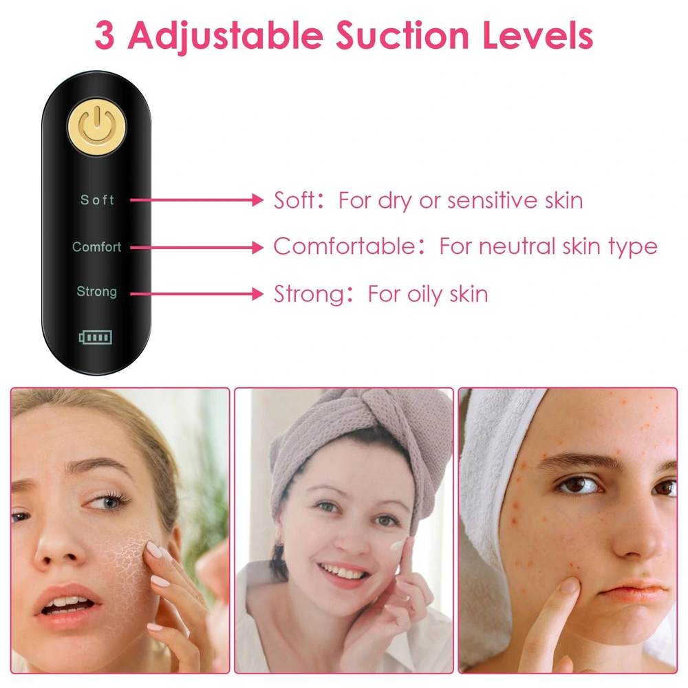 Product image showing a facial cleansing device with three adjustable suction levels for different skin types: soft for dry or sensitive skin, comfortable for neutral skin, and strong for oily skin.