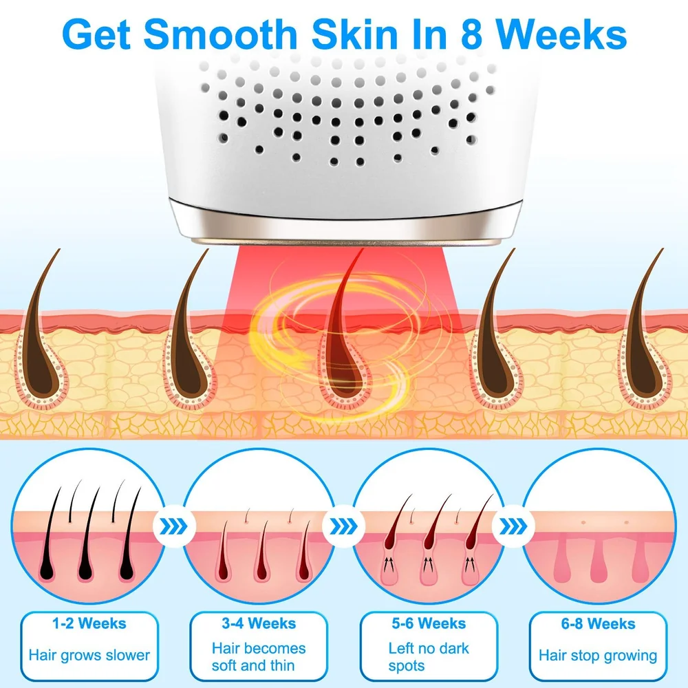 Illustration demonstrating the results of a hair removal device, showing stages of hair growth reduction over 8 weeks, with a focus on achieving smooth skin.